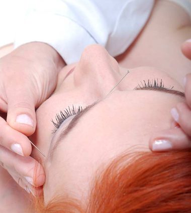 Facial-Acupuncture